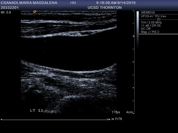 Mami’s Followup Blood Clot Ultrasound PAC's Worlds